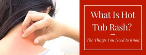 What Is Hot Tub Rash The Things You Need to Know