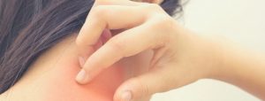 What You Need to Know about Hot Tub Folliculitis